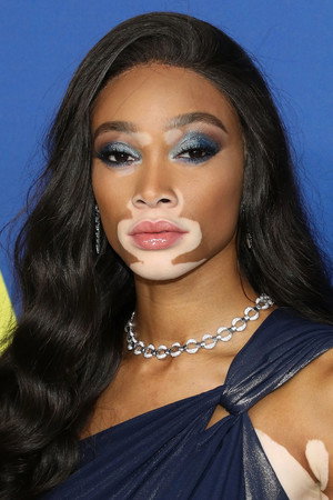 Winnie Harlow profil kép