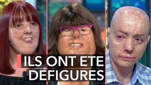 Ça commence aujourd'hui 1. évad Ep.15 15. epizód