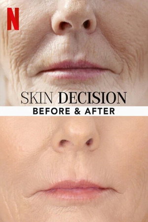 Skin Decision: Before and After poszter