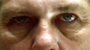 Dr. House 3. évad Ep.1 Jelentés