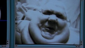 Dr. House 3. évad Ep.6 Lesz, ami lesz