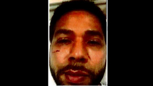 Jussie Smollett: Anatomy of a Hoax 1. évad Ep.1 1. epizód