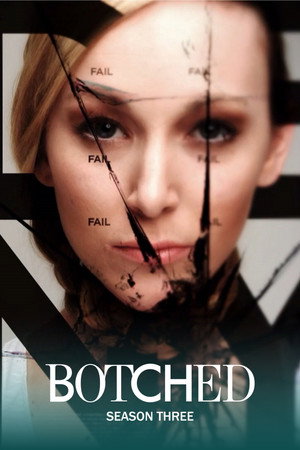 Botched 3. évad (2016-05-10) poszter