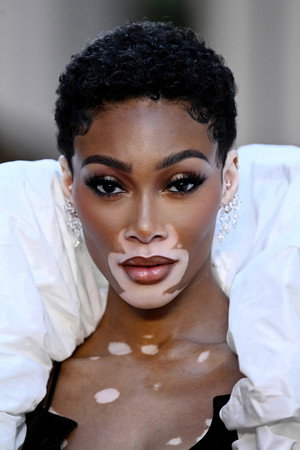 Winnie Harlow profil kép