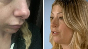 Botched 5. évad Ep.14 14. epizód