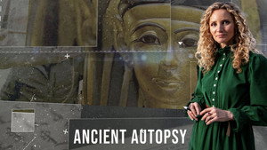 Ancient Autopsy kép