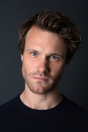 Hugh Skinner profil kép