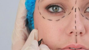 Plastic Surgery Knifemares kép