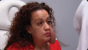 Botched 8. évad Ep.20 20. epizód